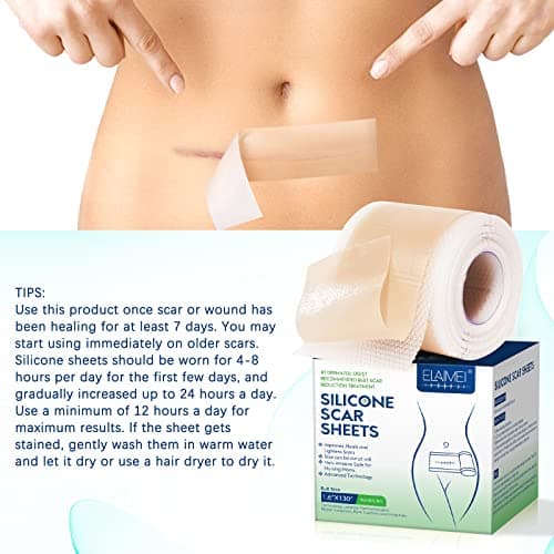 Feuilles de cicatrice en silicone (1,6"x130"-3,3M), bandes de ruban adhésif en silicone de qualité médicale pour incisions chirurgicales, césarienne, chéloïde, acné
