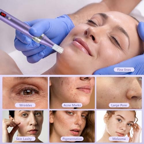 QUELLE Dermapen Microneedling Professionnel 5 Vitesses avec Écran LCD et 16 Aiguilles,Microneedling Visage Réglable de 0 à 2.0mm,Microneedling Pen Pour les Soins de la Peau