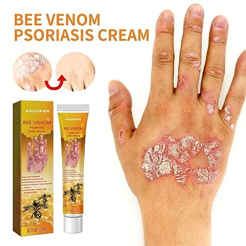 Crème Bee, Creme Psoriasis, Kaluofan 2PCS Youth d'abeille Psoriasis, Pierre Jaune Poudre Psoriasis, D'abeille,Crème D'abeille Crème de Psoriasis Bee