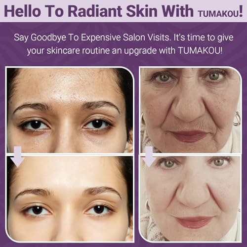 Appareil Radiofréquence Visage - TUMAKOU 4 en 1 EMS Micro-courant Appareil Anti Rides Visage - Bleu Rouge Luminothérapie Visage - Appareil Massage Lifting Visage Pour le Visage, le Cou à Domicile