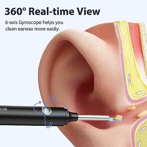 Otoscope Oreille, Hopefox 1080P Camera Oreille IP67 Étanche, Outil d'élimination du Cérumen, Endoscope WIFI Nettoyant Oreille Kit avec 6 Lumières LED, Adapté aux iPhone, iPad et Android