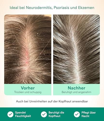 Natüür Scalp Oil – 10 ml Soin intensif pour cuir chevelu sec avec ingrédients naturels, sans parfum, silicone ni colorants – Avec extrait de neem
