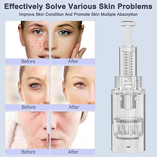 30 Pièces Aiguille Microneedling 36 Pin Dermapen Needling De Remplacement Dermapen Aiguilles Microneedling Cartouches Pour Micro Needle Gerät Pen Pour Auto Derma Stylo à Micro Aiguille Nadeln
