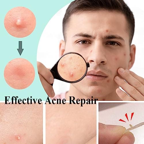 Zemolo 300PCS Patch Boutons Acne, Patch Acne Pimple Anti-Acné Imperméable Autocollants Hydrocolloïde pour Boutons Invisible pour Soin de la Peau