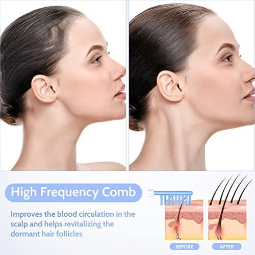 Yofuly Appareil Haute Fréquence avec 4 Bleu, Haute Fréquence Portable Visage Baguette, Outils de Beauté Facialepour Réduire Les Rides, Les Yeux Gonflés, Les Cernes, La Perte de Cheveux