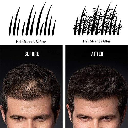 Poudre Cheveux,Densifiante Poudre Volume Chatain Calvitie Homme Hair Building Fibers?Brun foncé?