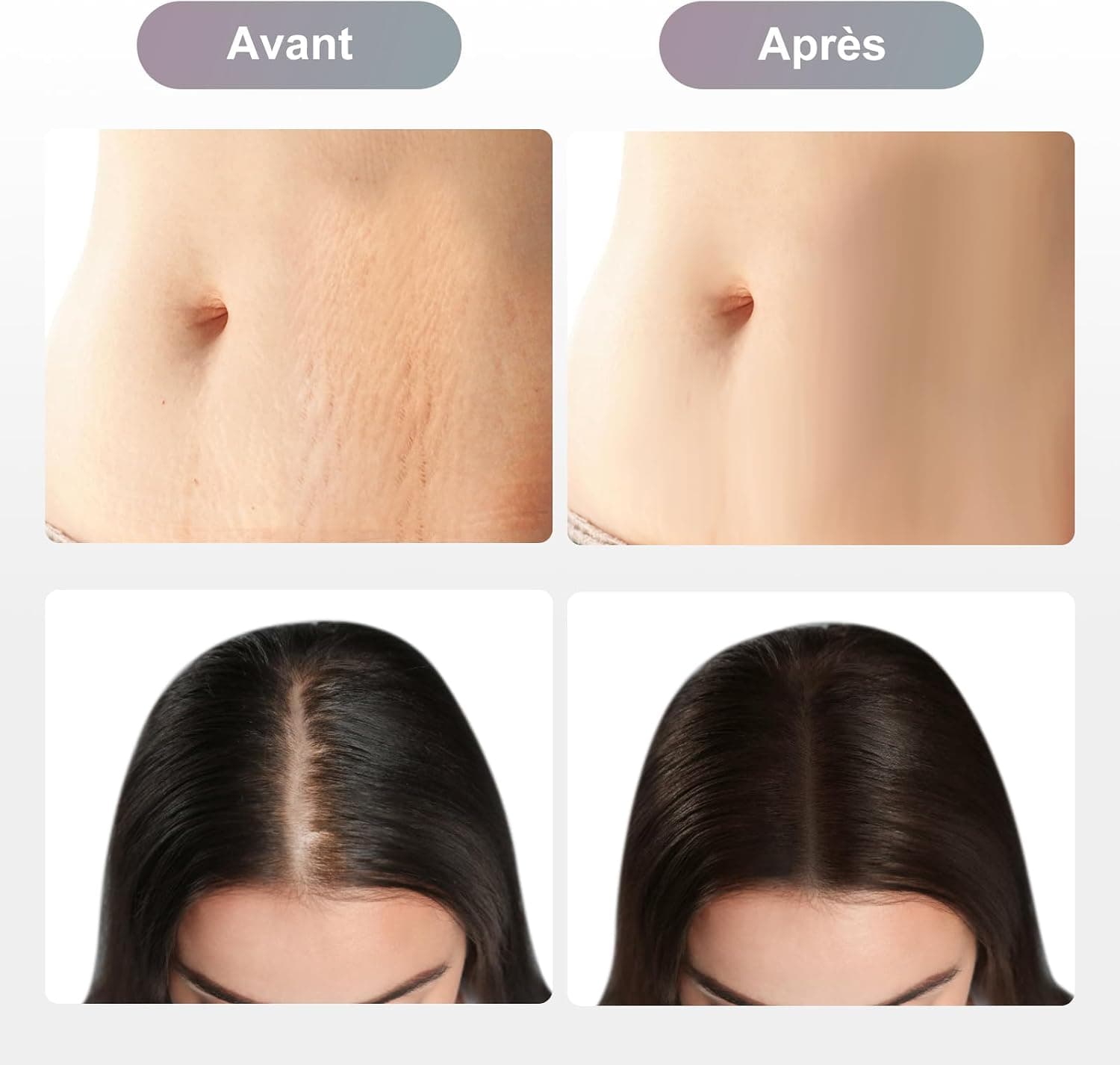 Dr. Pen Ultima M8 Stylo Microneedling Beauté Sans Fil avec 8 Cartouches