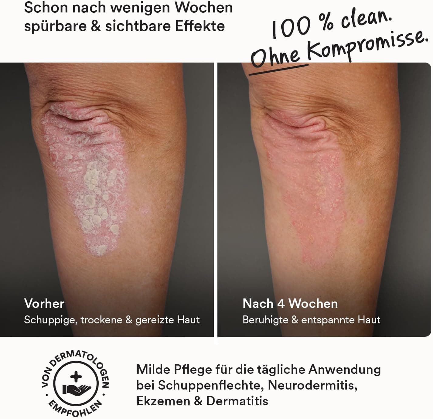 Crème 50 ml | Crème pour le corps pour peaux irritées et sensibles | Crème hydratante naturelle avec Neemavera | Soin parfait pour le quotidien sans parfum | Moisturizer végétalien