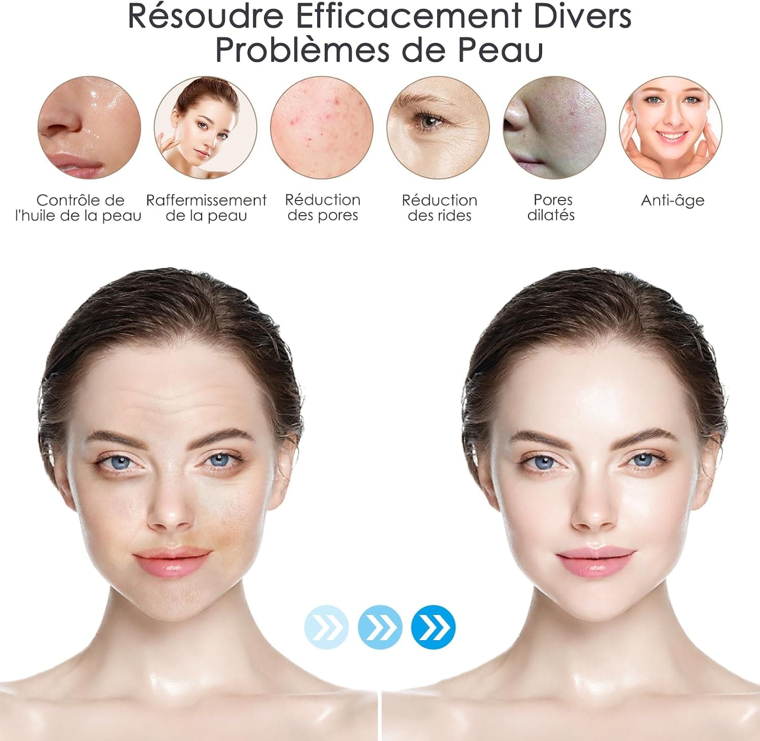 Dr. Pen Ultima M8 Stylo Microneedling Beauté Sans Fil avec 8 Cartouches