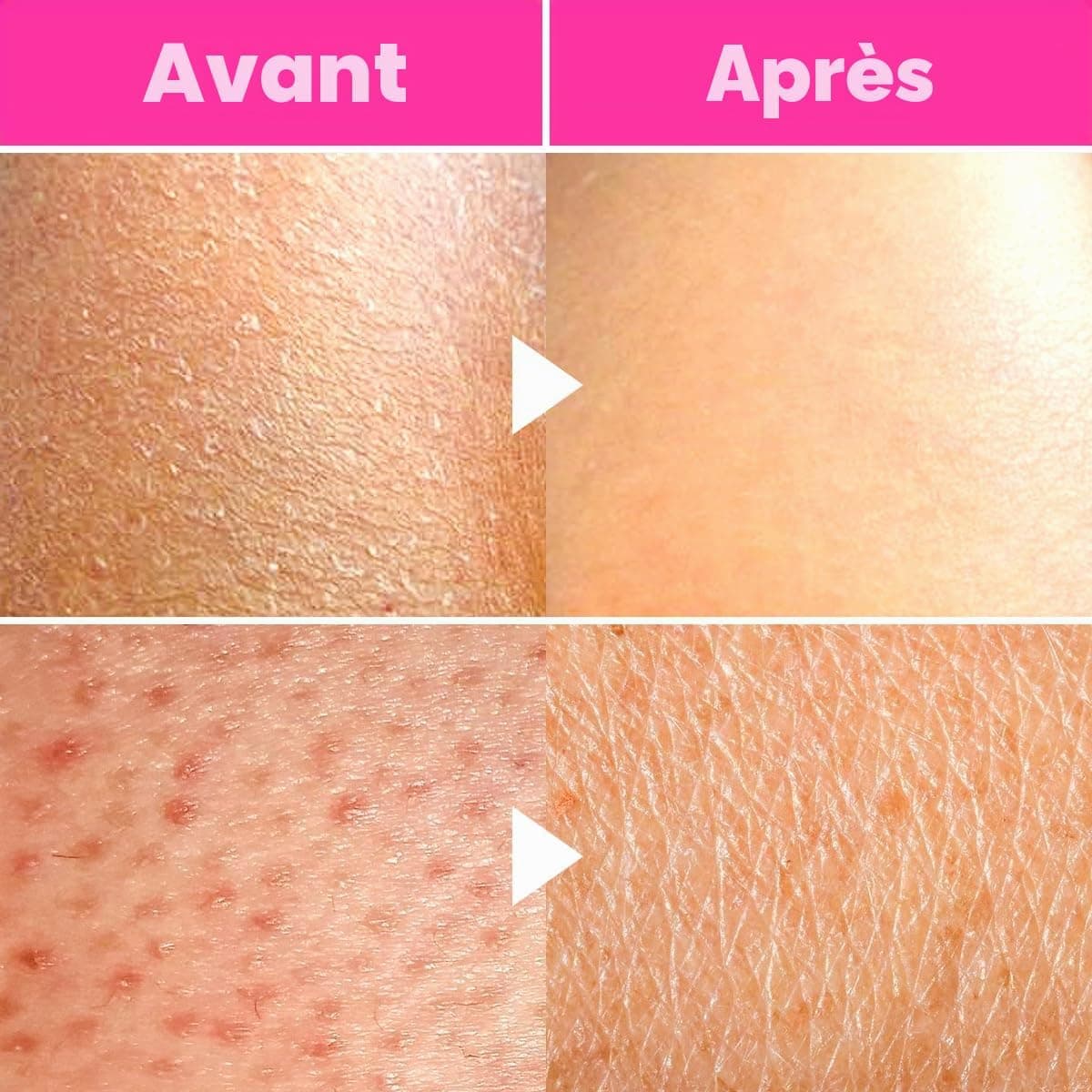 âme pure® So Silky MittTM Gant exfoliant en soie pure pour le corps - Gant pour peau lisse - Hammam