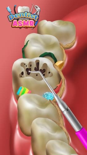 Dentist Office - Dental Teeth & Root Canal Simulator Kids Surgery Games ASMR