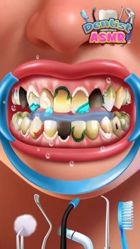 Dentist Office - Dental Teeth & Root Canal Simulator Kids Surgery Games ASMR