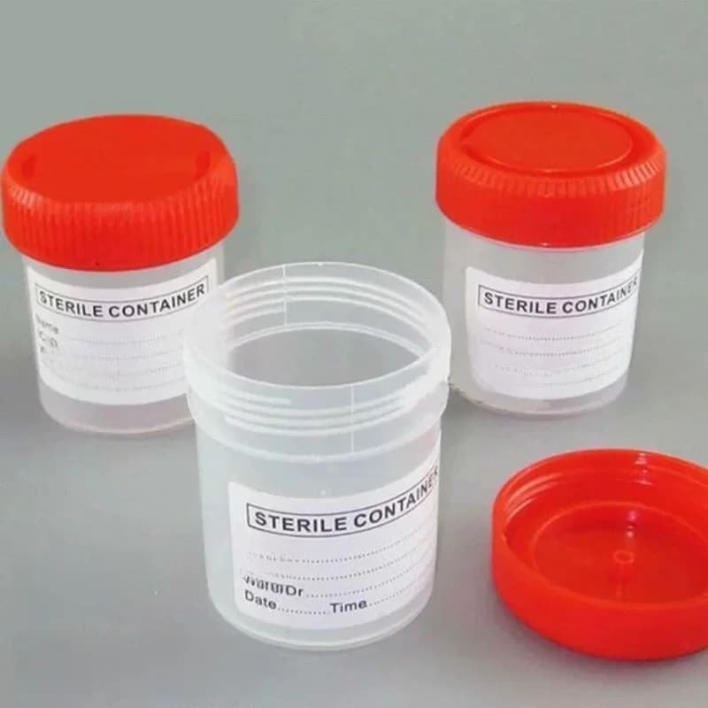 Tasse d'échantillon de collecte d'urine, 5 pièces, bouteille d'échantillon, conteneur de tasse en plastique de 60ML à utiliser