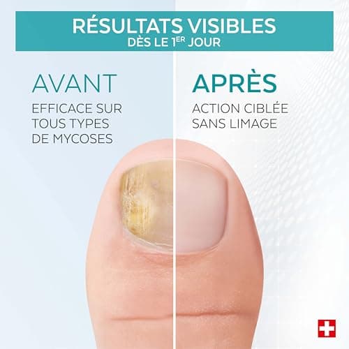 PODERM - MYCOSE ONGLE TRAITEMENT 2en1 | Aux plantes exceptionnelles puissantes antifongiques et réparatrices | Soin professionnel pied/main | Facile & rapide | Swiss Made
