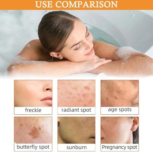 Savon Au Curcuma,Savon à L'acide Kojique,Savon Curcuma Visage,Savon Exfoliant Au Curcuma,Savon Exfoliant Au Curcuma Naturel,Barre de Savon Au Curcuma pour Visage et Corps,Nettoyage en Profondeur,100g