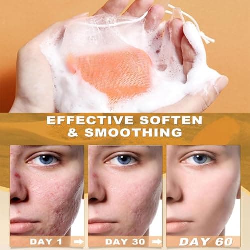 Savon Au Curcuma,Savon à L'acide Kojique,Savon Curcuma Visage,Savon Exfoliant Au Curcuma,Savon Exfoliant Au Curcuma Naturel,Barre de Savon Au Curcuma pour Visage et Corps,Nettoyage en Profondeur,100g