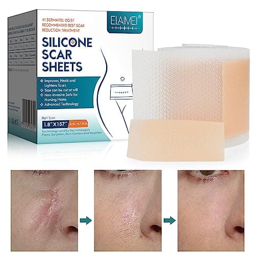 Feuilles de cicatrice en silicone (1,8 "x 120" -3M), bandes de ruban adhésif en silicone de qualité médicale pour incisions chirurgicales, césarienne, chéloïde, acné
