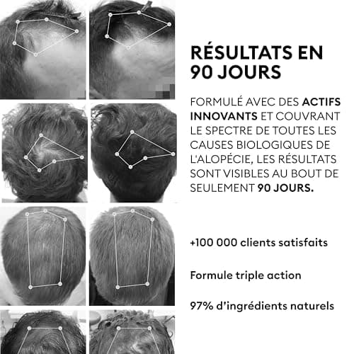 OMA & ME Protocole de Repousse de Cheveux 3 en 1 - Sérum Traitement Pousse Cheveux et Anti Chute Cheveux - Croissance et Réduction des Chutes - Fabriqué en France - 12 Fioles de 6ml (Cure de 1 mois)
