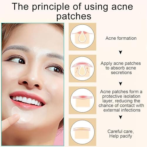 EUZUXU 40 Patchs Acné Patch, Pimple Patch, Patch Acne Pimple Anti-Acné Imperméable Autocollants Hydrocolloïde pour Boutons Invisible pour Soin de la Peau